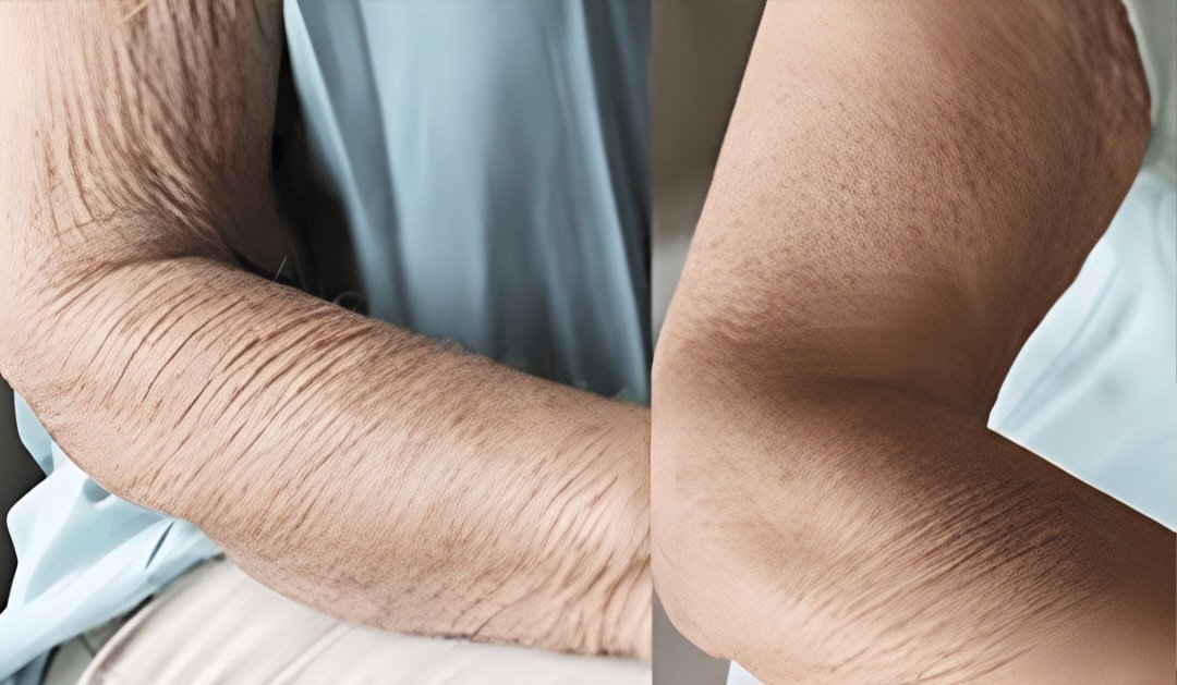 How to care for aging skin 25 495574598 1103176975180210 1493552565037312545 n 1