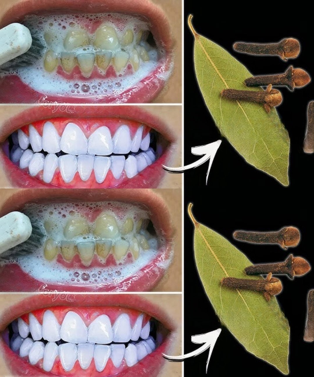 Remove tartar and whiten your teeth naturally 25 533656545 1065469045801888 3749655483731307809 n