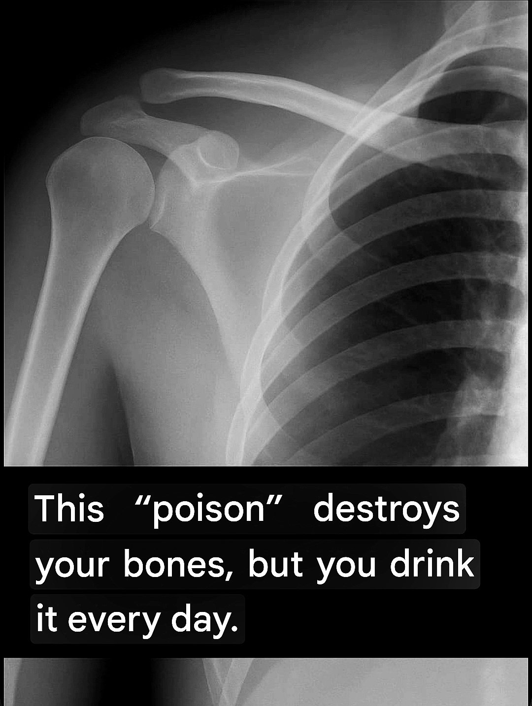 This “poison” damages your bones – and you drink it every day! 25 Screenshot 20251027 221909 Google