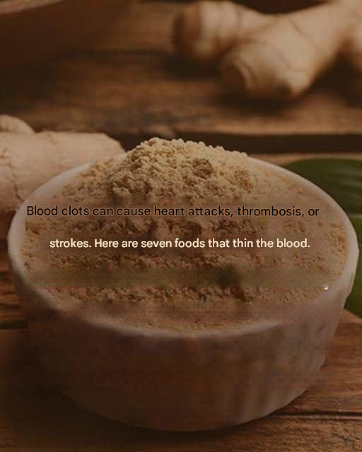 A blood clot can lead to a heart attack, thrombosis, or stroke: Here are 7 powerful blood-thinning foods you need to know about 25 translated image 39