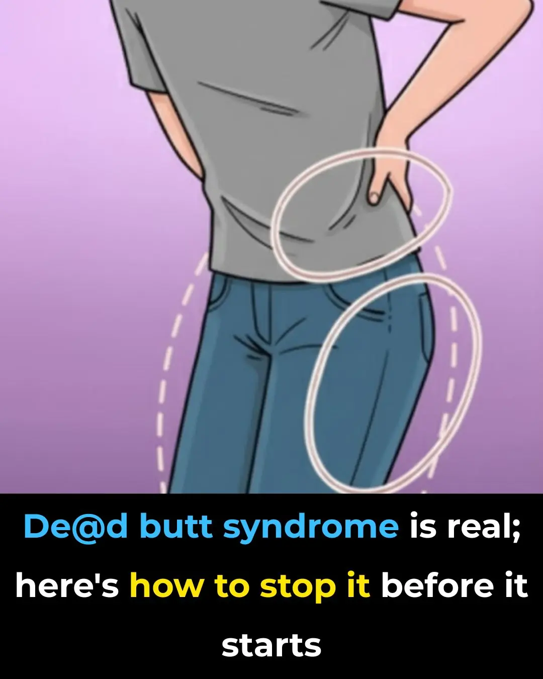 Dead Butt Syndrome Is Real 25