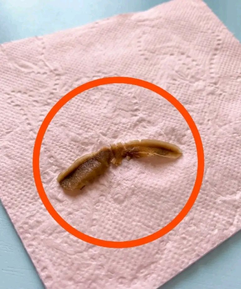 Au premier abord, l'objet semble être un fragment de quelque chose de biologique. Sa forme irrégulière, sa texture molle et ses bords légèrement translucides suggèrent qu'il s'agit d'un fragment d'insecte ou peut-être d'un reste alimentaire, plutôt que d'un objet mécanique ou artificiel. Son aspect segmenté, notamment la partie centrale qui ressemble à une articulation, pourrait évoquer une partie du corps d'un insecte, comme une patte ou une antenne. Cependant, il pourrait aussi s'agir d'un morceau d'aliment cuit ou transformé ayant pris une forme inhabituelle. La couleur et la texture de la surface sont des détails importants. Sa teinte brunâtre, associée à un aspect légèrement brillant, peut indiquer une exposition à la chaleur, à l'humidité ou à des huiles. De ce fait, on pourrait la confondre avec un petit morceau de viande, des crustacés, voire une racine. Bien souvent, des aliments courants peuvent avoir une apparence étonnamment étrange lorsqu'on les ouvre ou qu'on les examine de près. 25 1783006314774 1